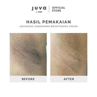 ADVANCE UNDERARMS BRIGHTENING CREAM-thumb-3