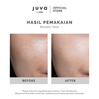 MANDELIC TONER-thumb-2