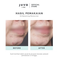 OIL BALANCING MOISTURIZER-thumb-4